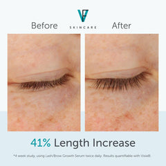 Before and after comparison of eyelash length with skincare brand logo.