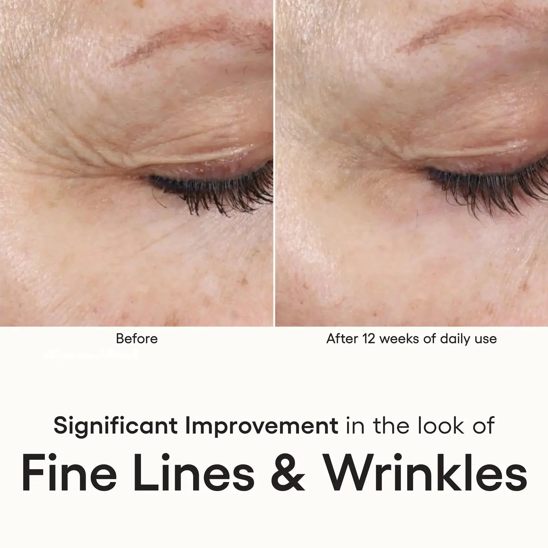 Before and after comparison of fine lines and wrinkles on skin with text indicating improvement.