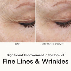Before and after comparison of fine lines and wrinkles on skin with text indicating improvement.
