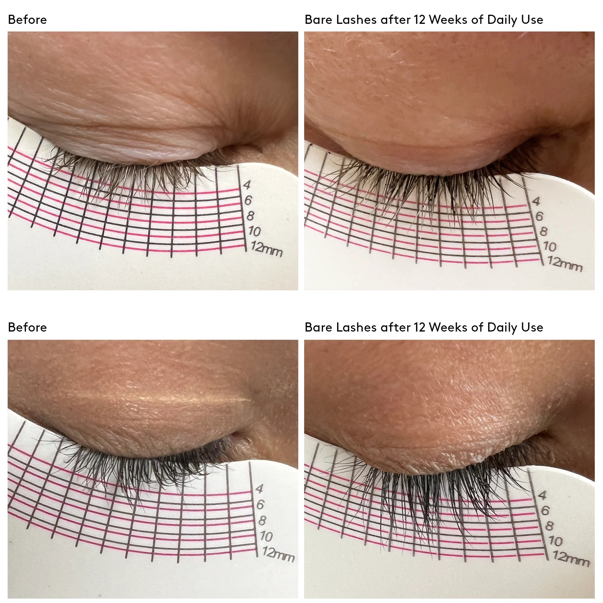 Before and after comparison of bare eyelashes with a lash growth product over 12 weeks, using a ruler for measurement.