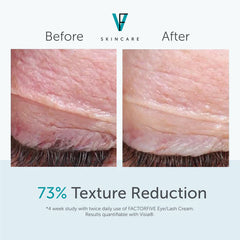 Before and after comparison of skincare texture reduction with visible improvement on a light background.