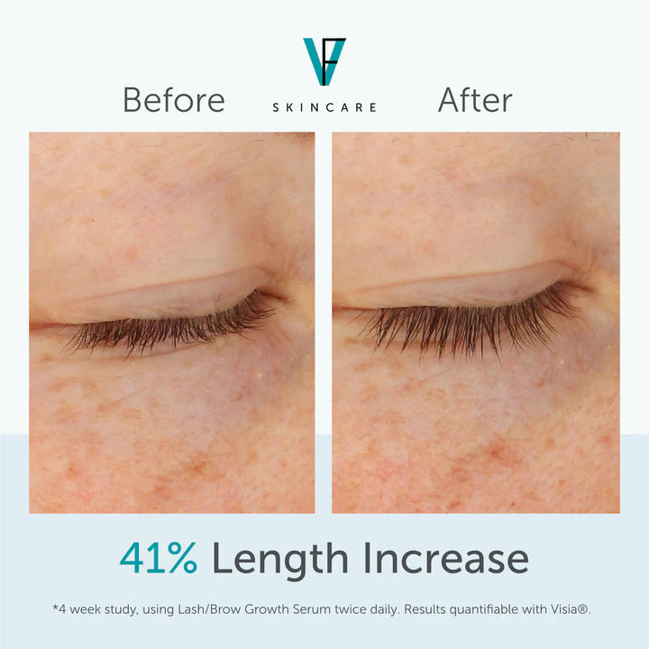 Before and after comparison of eyelash length with skincare brand logo.