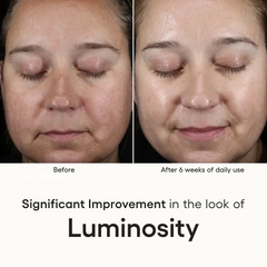Before and after comparison of a woman's face with text indicating improvement in luminosity after 6 weeks of daily use.
